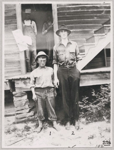 Hookworm effects, North Carolina, May 29, 1913. Rockefeller Archive Center, Sleepy Hollow, N.Y.